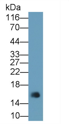 再生胰島衍生蛋白3γ(REG3g)單克隆抗體