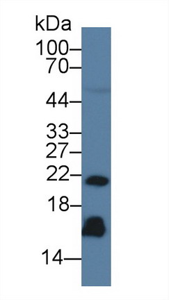 再生胰岛衍生蛋白3γ(REG3g)单克隆抗体