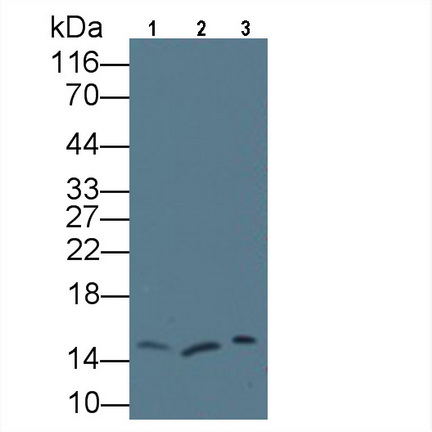再生胰岛衍生蛋白3γ(REG3g)单克隆抗体