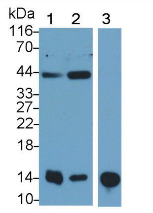 再生胰岛衍生蛋白3γ(REG3g)单克隆抗体