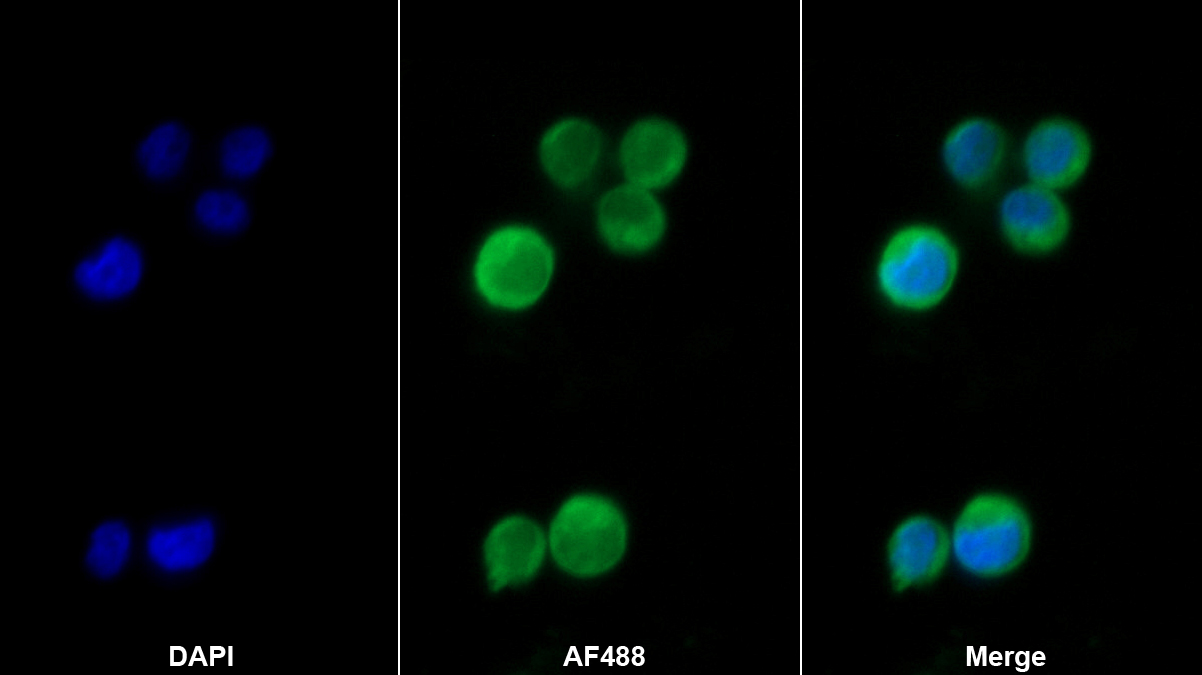 核因子κB抑制因子ε(IkBe)單克隆抗體