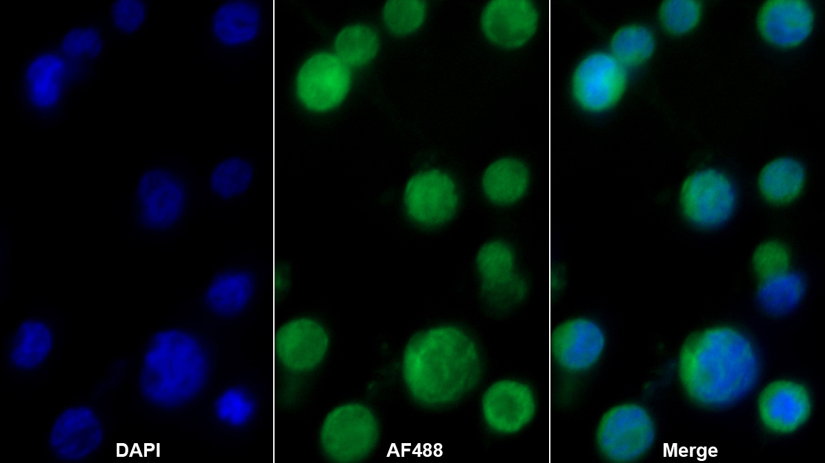 核因子κB抑制因子ε(IkBe)單克隆抗體