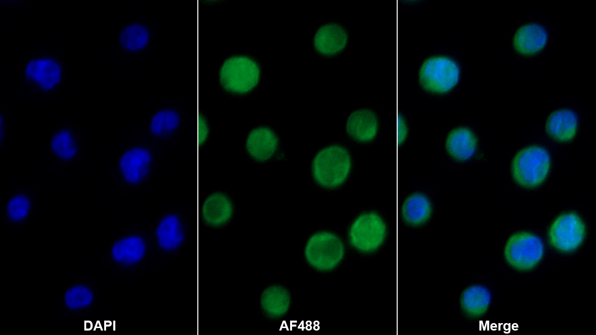 核因子κB抑制因子ε(IkBe)單克隆抗體