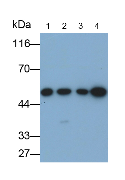 微管蛋白β3(TUBb3)单克隆抗体