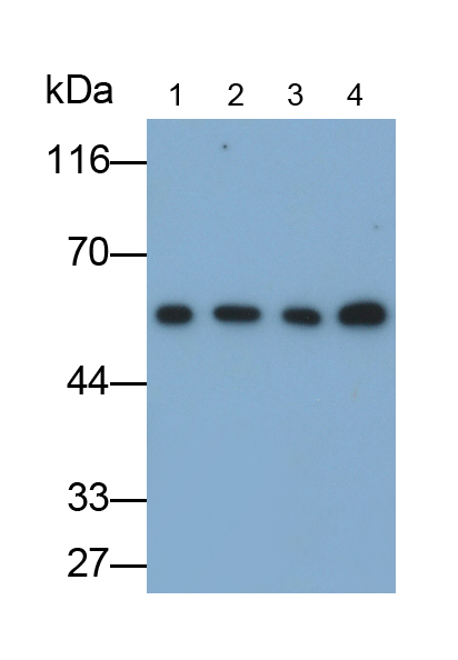 微管蛋白β3(TUBb3)单克隆抗体