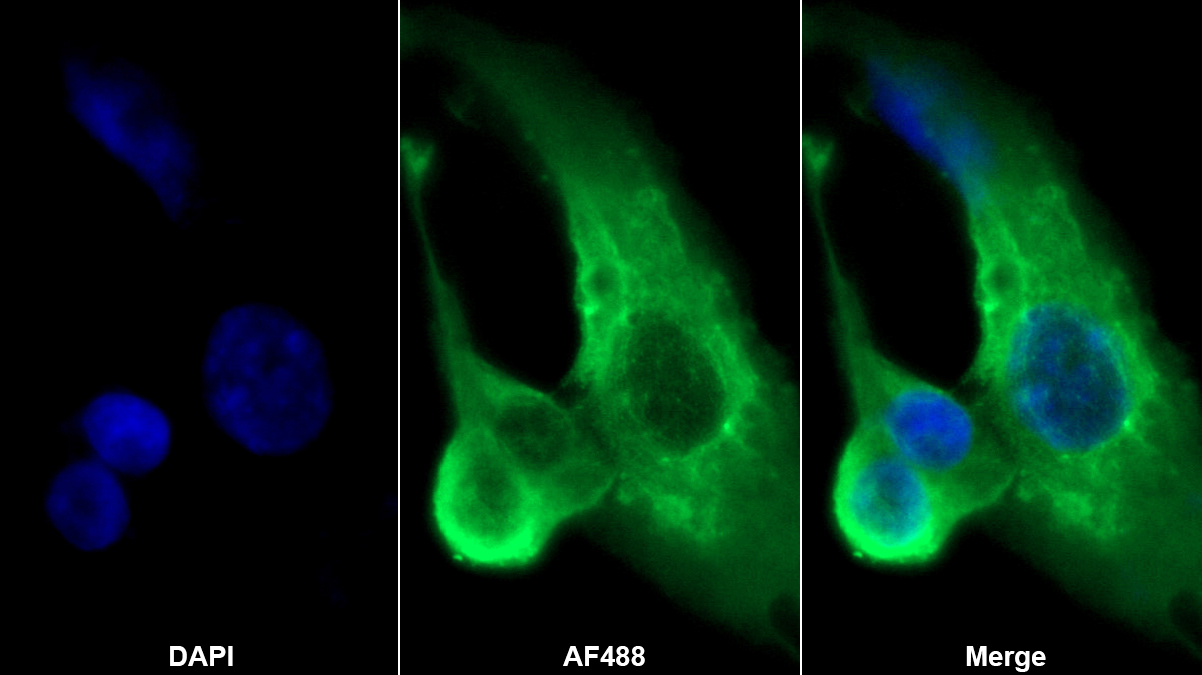 親核素α2(KPNa2)單克隆抗體