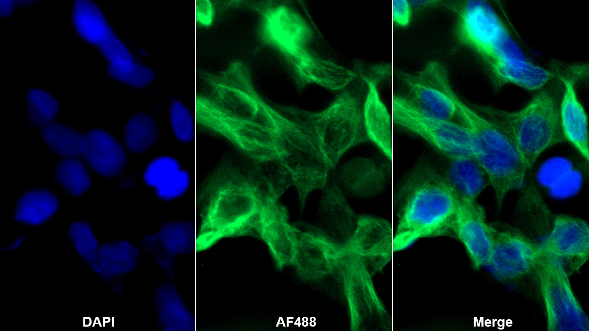 親核素α2(KPNa2)單克隆抗體