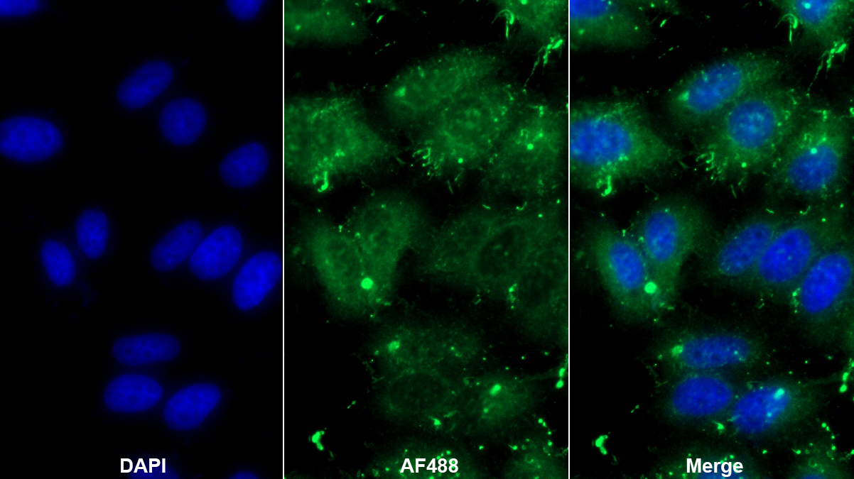 膜聯(lián)蛋白A4(ANXA4)單克隆抗體