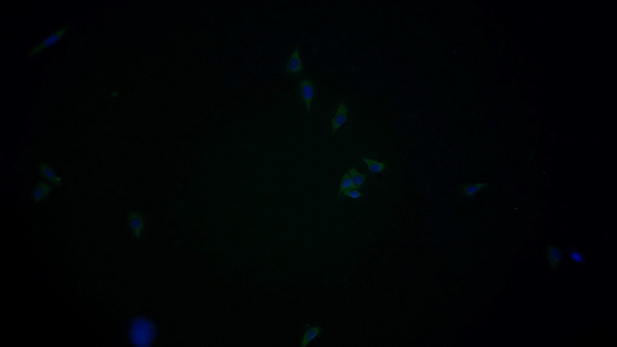 膜聯(lián)蛋白A3(ANXA3)單克隆抗體