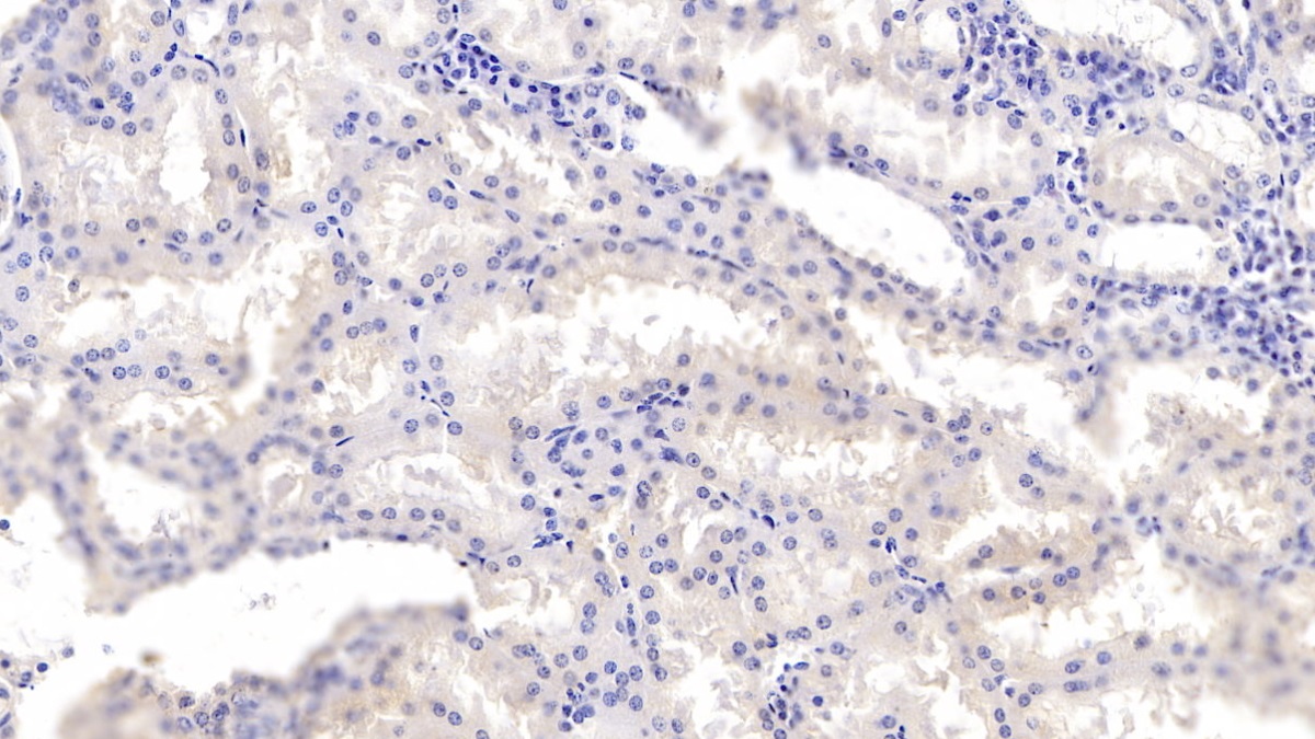 膜聯(lián)蛋白A3(ANXA3)單克隆抗體