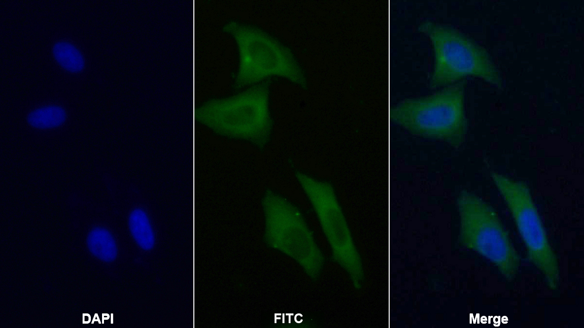 膜聯(lián)蛋白A3(ANXA3)單克隆抗體