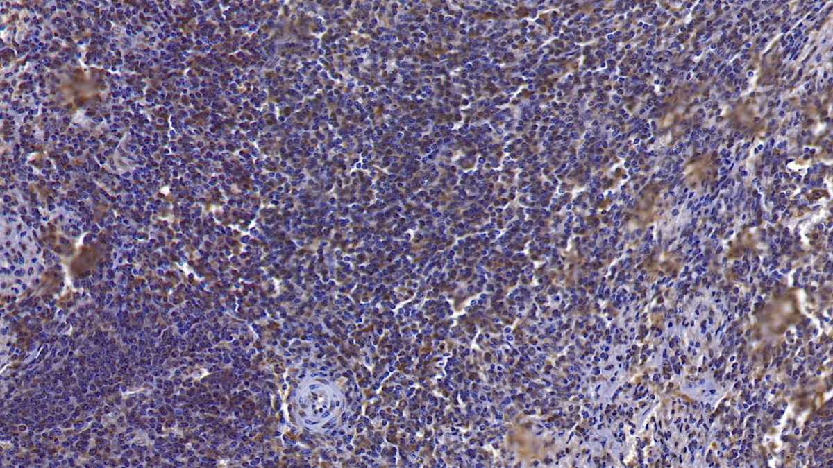膜聯(lián)蛋白A3(ANXA3)單克隆抗體