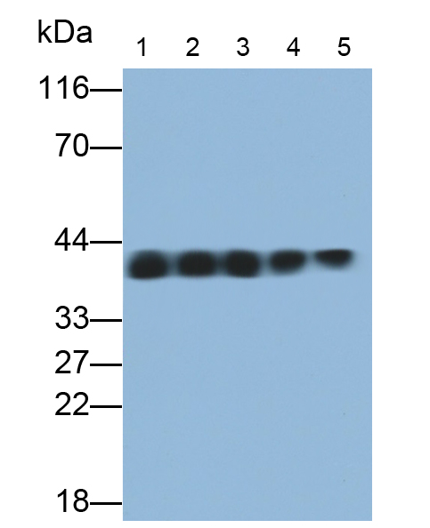 膜联蛋白A1(ANXA1)单克隆抗体