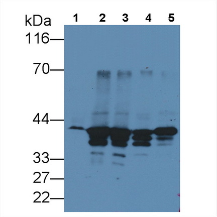 膜聯(lián)蛋白A1(ANXA1)單克隆抗體