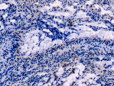 膜聯(lián)蛋白A1(ANXA1)單克隆抗體