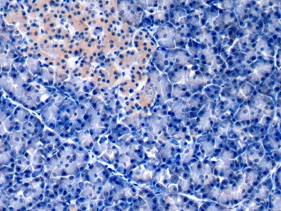 膜聯(lián)蛋白A1(ANXA1)單克隆抗體