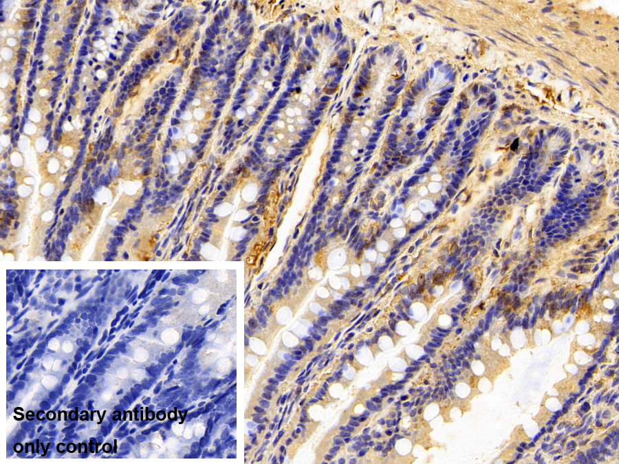 補體成分1q子成分C(C1qC)單克隆抗體