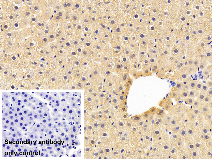 補體成分1q子成分C(C1qC)單克隆抗體