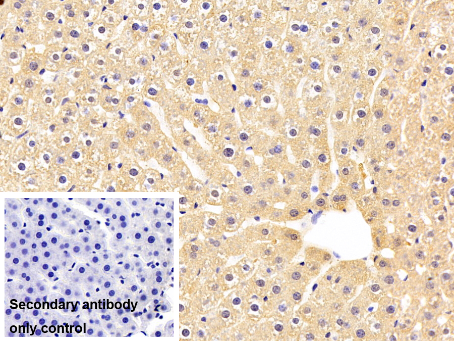 補體成分1q子成分C(C1qC)單克隆抗體
