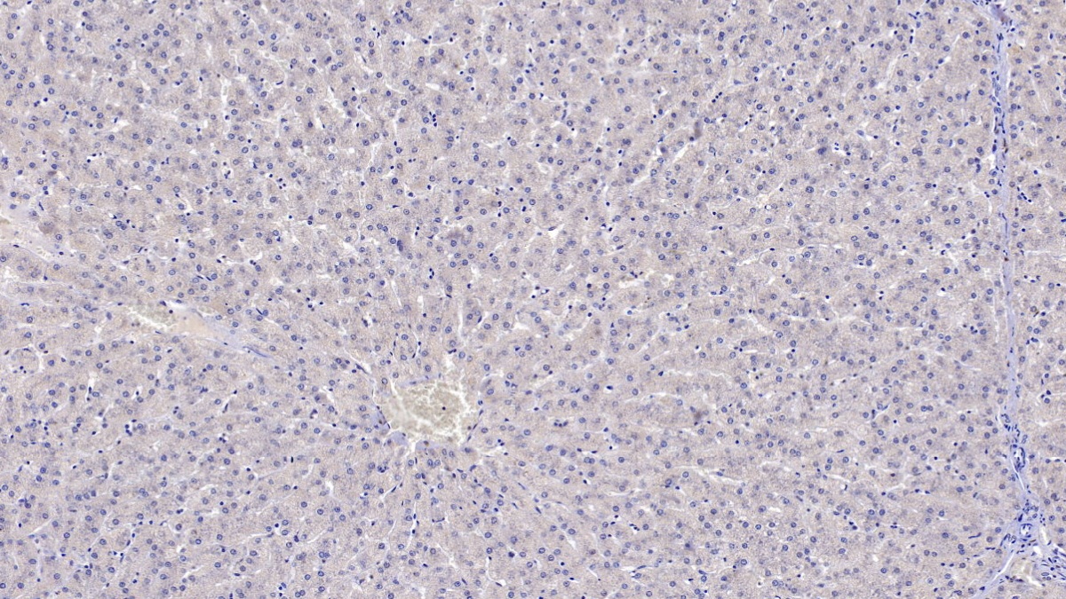 沉默調(diào)節(jié)蛋白3(SIRT3)單克隆抗體