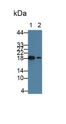熱休克蛋白β6(HSPb6)單克隆抗體