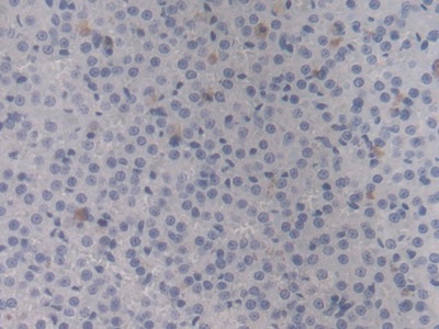 熱休克蛋白β6(HSPb6)單克隆抗體