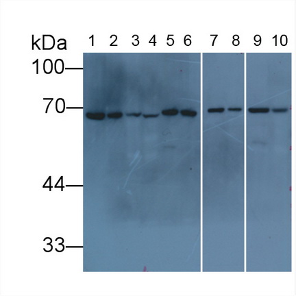 核纖層蛋白B1(LMNB1)單克隆抗體