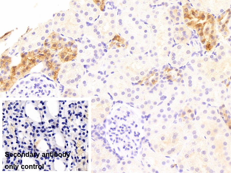 鈣結(jié)合蛋白(CALB)單克隆抗體