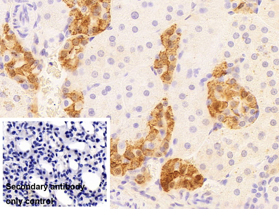 鈣結(jié)合蛋白(CALB)單克隆抗體