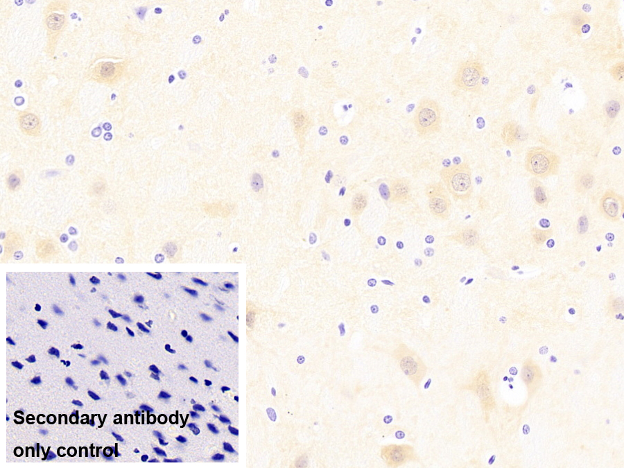 泛素羧基端酯酶L1(UCHL1)單克隆抗體