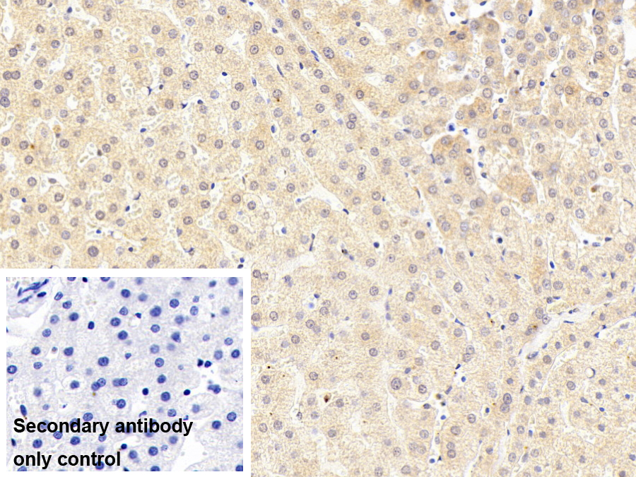 神經(jīng)損傷誘導(dǎo)蛋白1(NINJ1)單克隆抗體