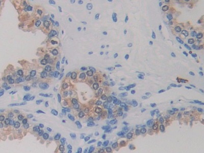 異檸檬酸脫氫酶1(IDH1)單克隆抗體
