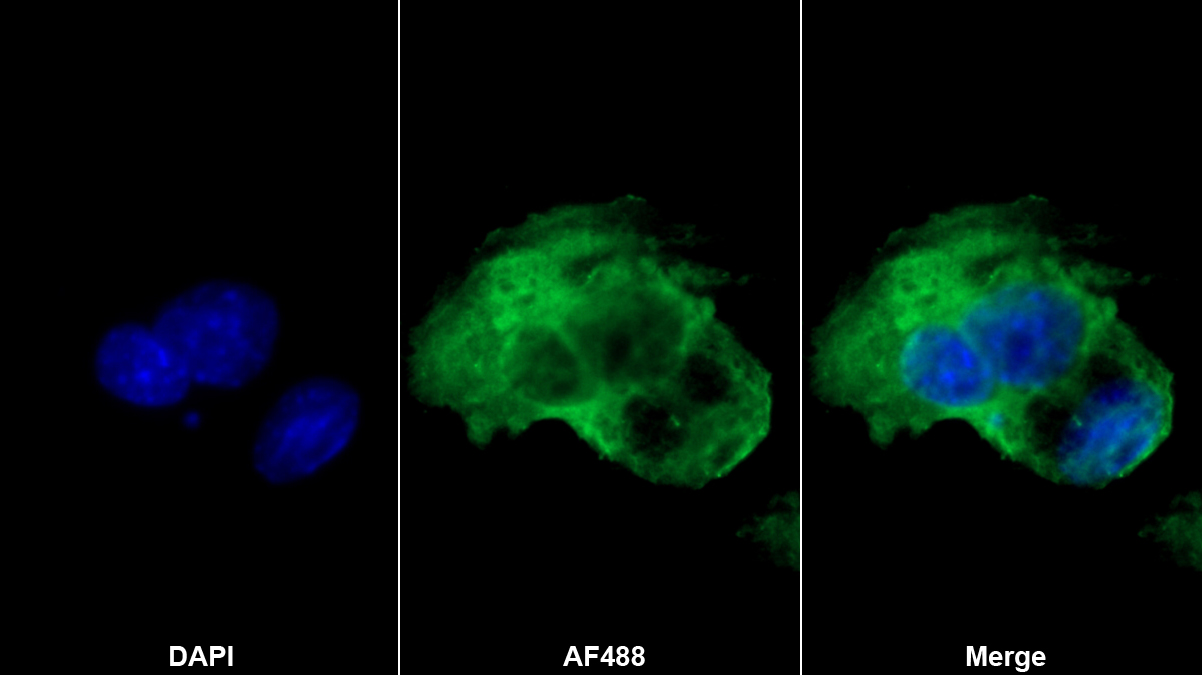 雙糖鏈蛋白聚糖(BGN)單克隆抗體