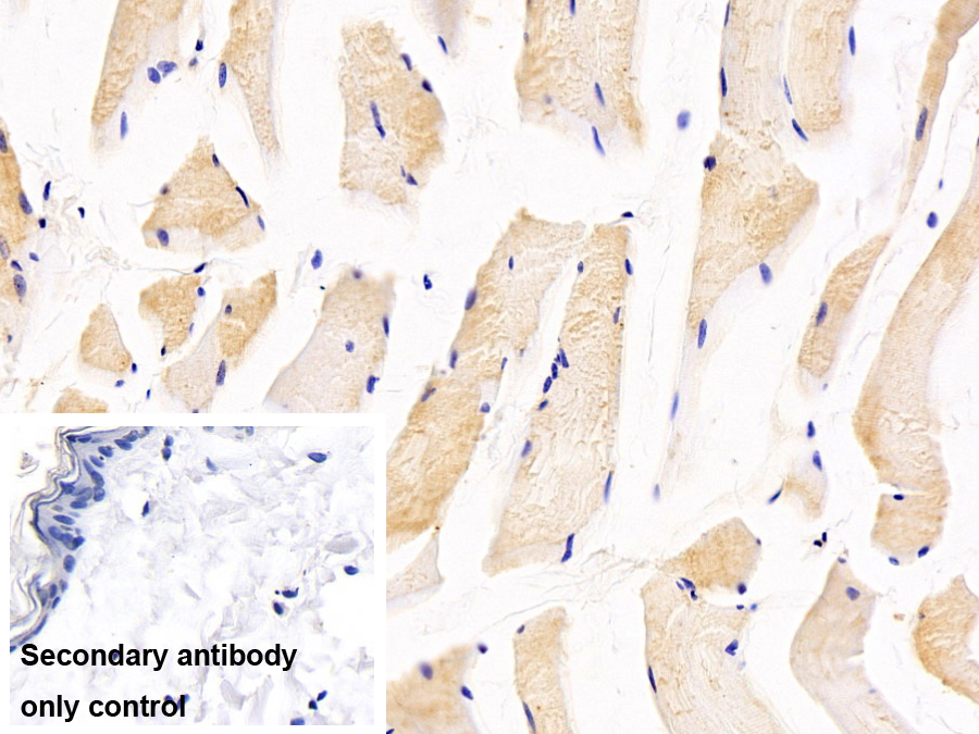 半胱氨酸蛋白酶抑制劑6(CST6)單克隆抗體