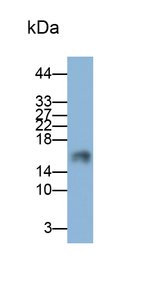 半胱氨酸蛋白酶抑制劑6(CST6)單克隆抗體