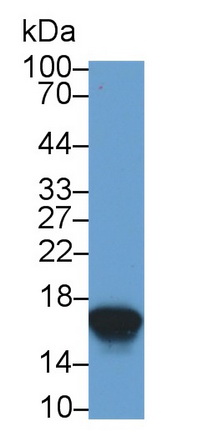 半胱氨酸蛋白酶抑制劑1(CST1)單克隆抗體