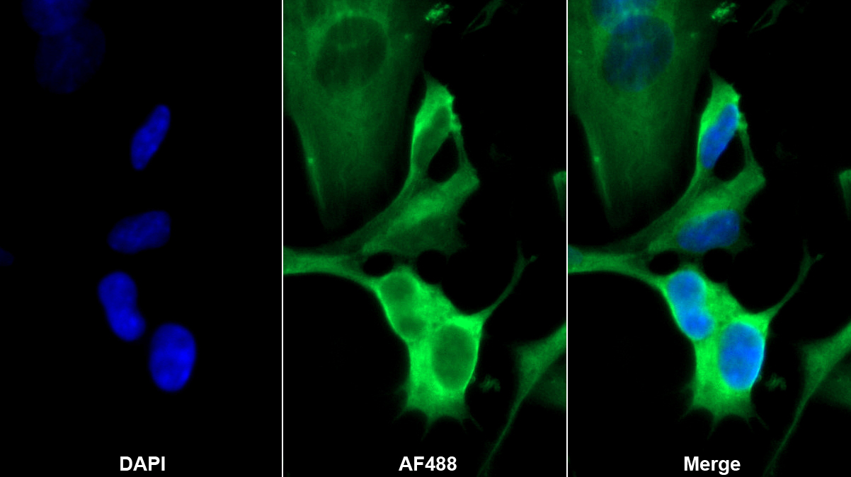 神經(jīng)酰胺激酶(CERK)單克隆抗體