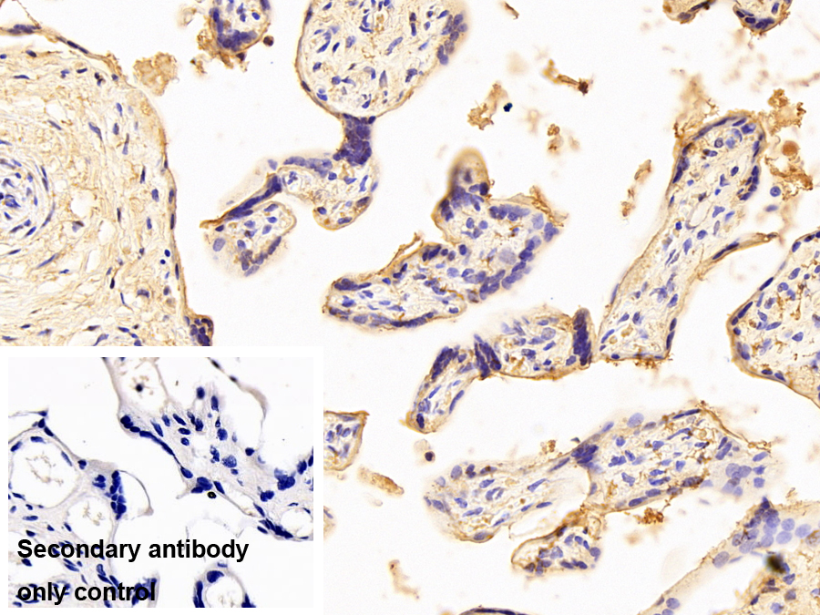 胎盤堿性磷酸酶樣蛋白2(ALPPL2)單克隆抗體