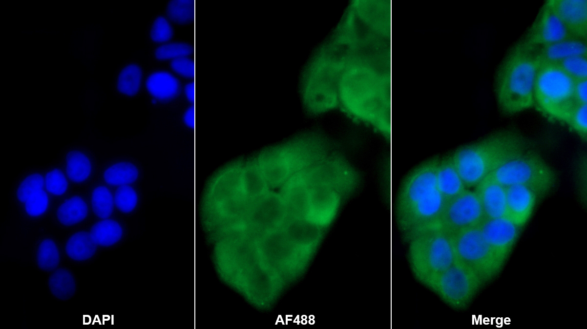 酪氨酸3/色氨酸5单加氧酶激活蛋白ζ(YWHAz)单克隆抗体
