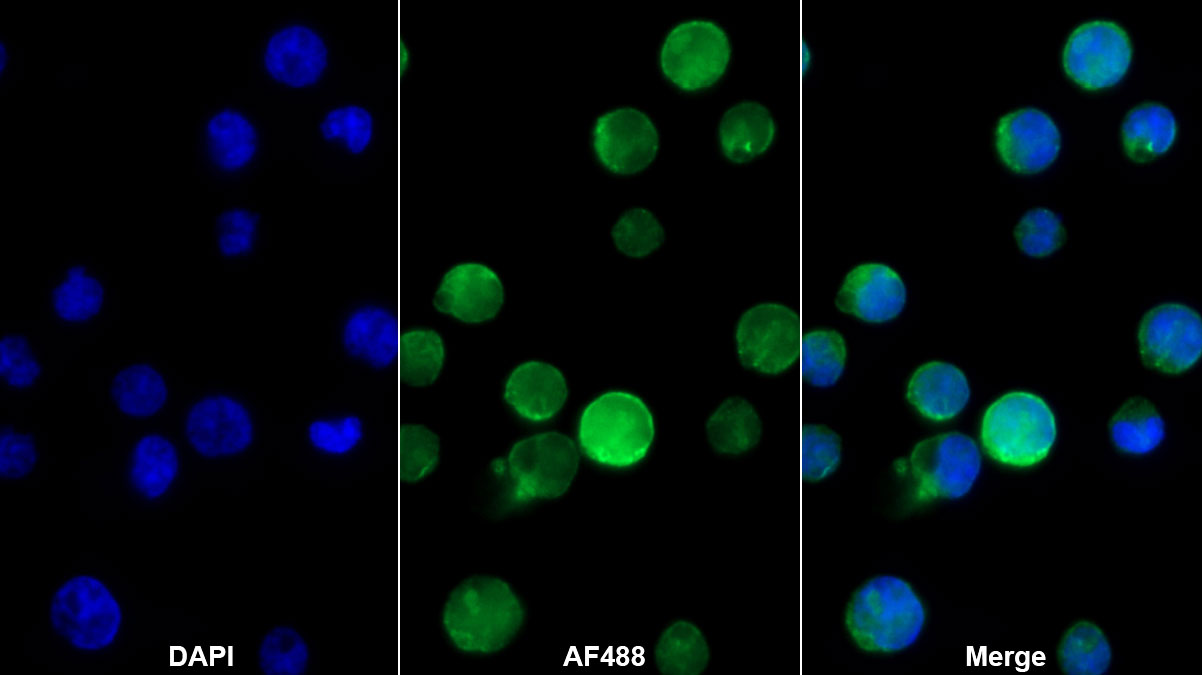 CD180分子(CD180)單克隆抗體