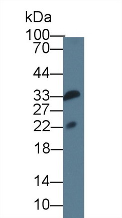 白介素1家族成员9(IL1F9)单克隆抗体