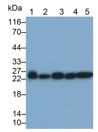 非ATP酶蛋白酶体26S亚基10(PSMD10)单克隆抗体
