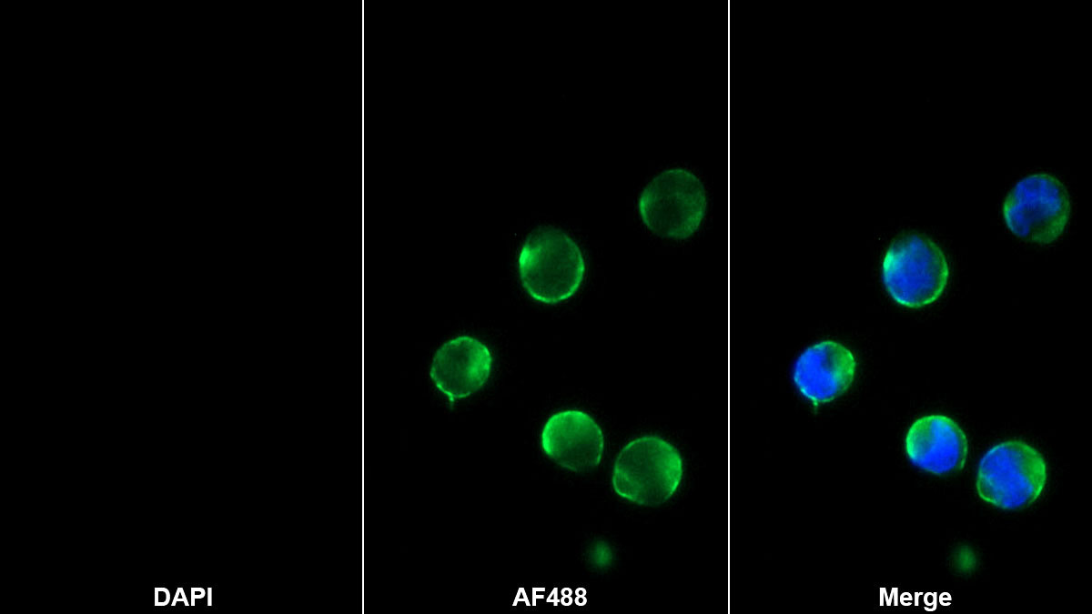 CD8b分子(CD8b)單克隆抗體