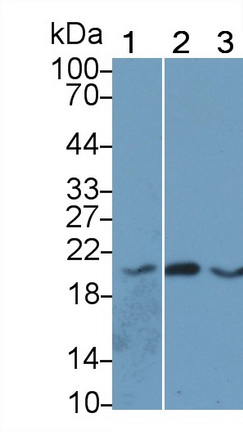 血管生成素样蛋白8(ANGPTL8)单克隆抗体
