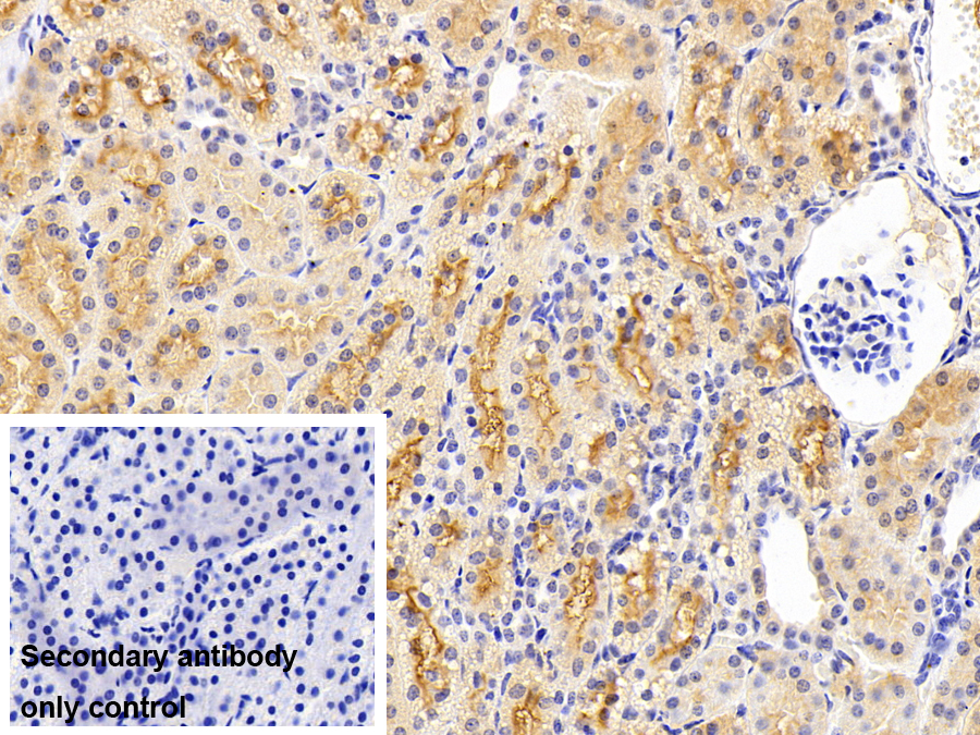 血管紧张素转化酶(ACE)多克隆抗体