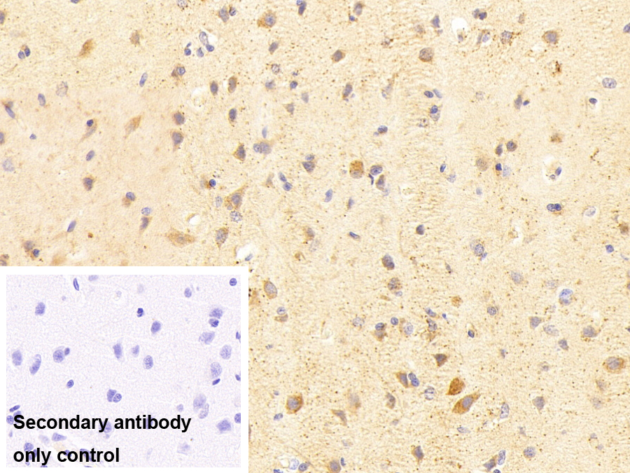 脑源性神经营养因子(BDNF)多克隆抗体