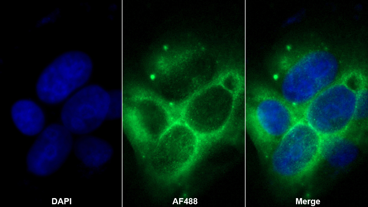 上皮性鈣黏附蛋白多克隆抗體