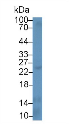 白介素12A(IL12A)多克隆抗体