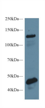 腦膜瘤表達(dá)抗原5(MGEA5)多克隆抗體