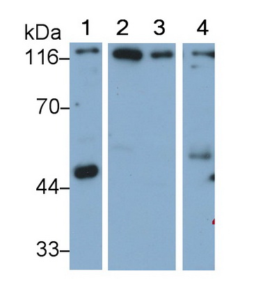 腦膜瘤表達(dá)抗原5(MGEA5)多克隆抗體